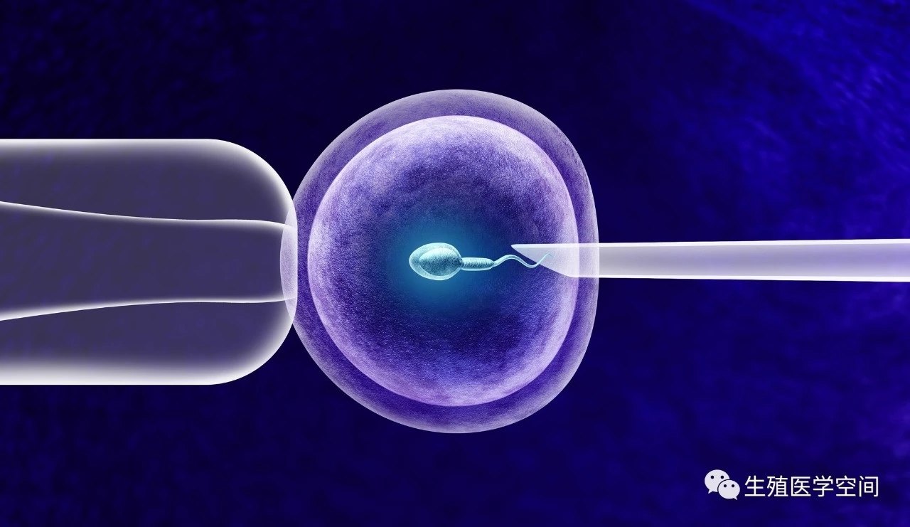 孕期产检项目解析