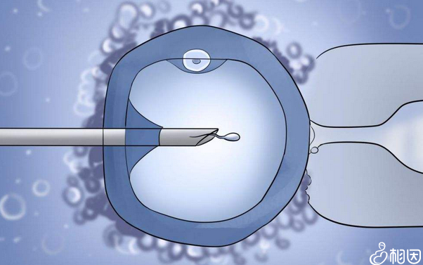 孕早期安琪儿孕酮水平变化趋势研究