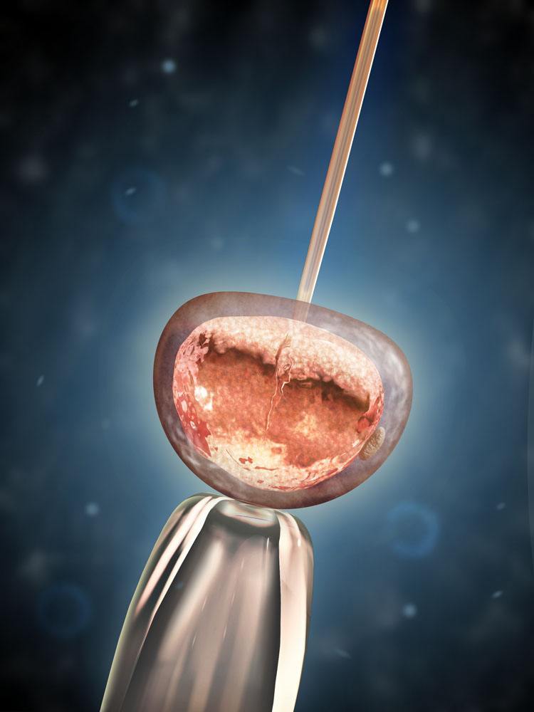 孕期营养补充剂科学使用指南