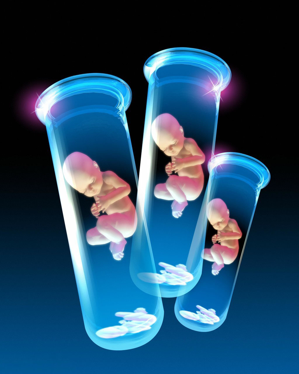 孕早期绒毛取样胎儿遗传信息分析